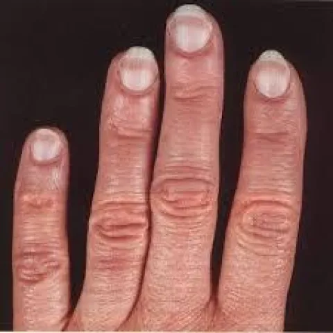 Terry's nails