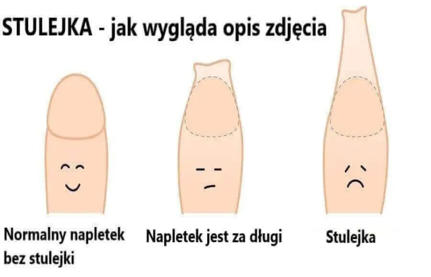 Stulejka 