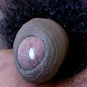 Wiewiór choroba