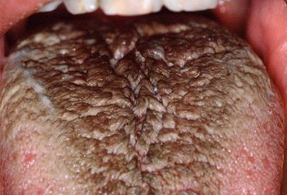 Czarny włochaty język