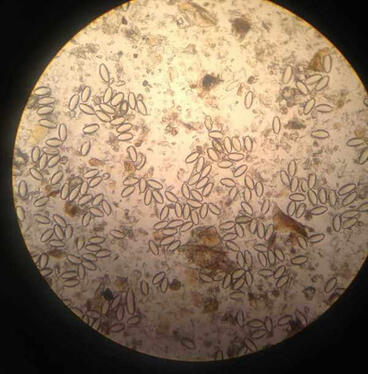 Jajka owsików pod mikroskopem