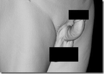 Prącie skrzywione do góry 