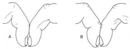 palce pałeczkowate test