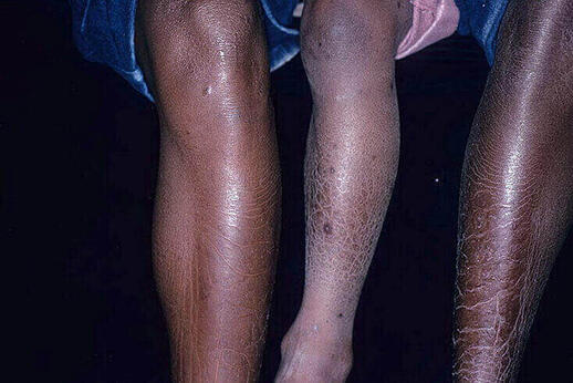 rybia łuska zdjęcia