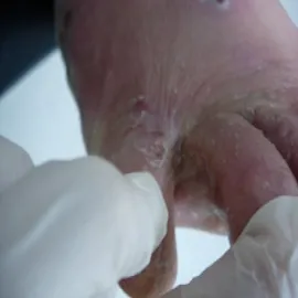 Stopa atlety zdjęcie