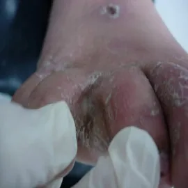 Stopa sportowca zdjęcie