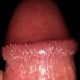 Wypustki na penisie grudki perliste