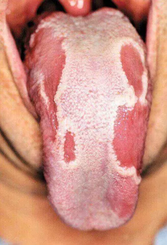 Język geograficzny u dorosłych