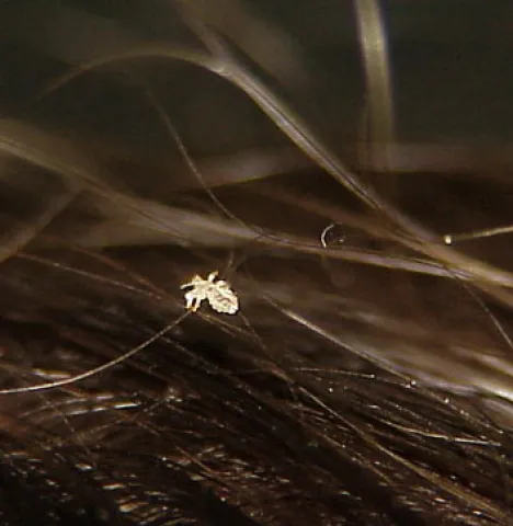 Wesz na włosach zdjęcie