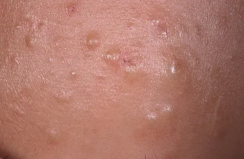 Wygląd zaskórniki zamknięte