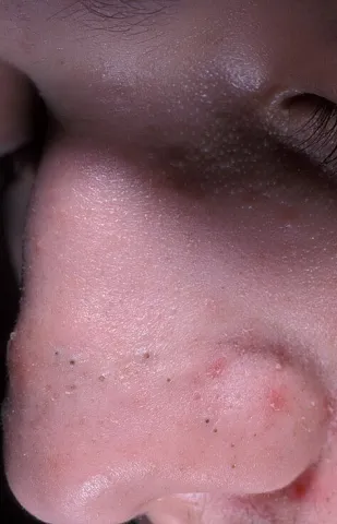 Zaskórniki otwarte brązowe lub czarne kropki