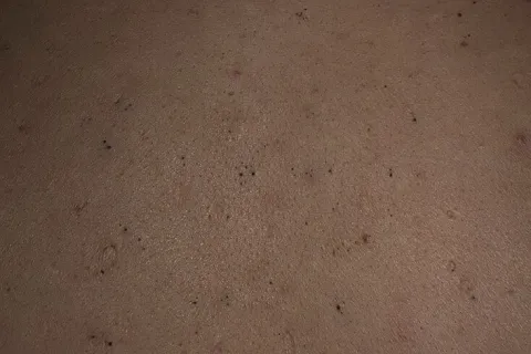 zaskórniki otwarte zdjęcie