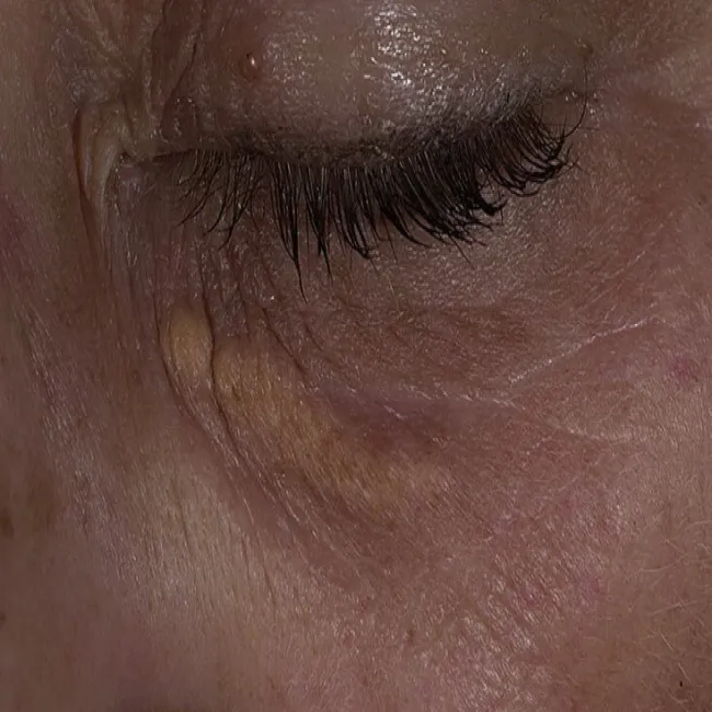 Kępki żółte zdjęcia 