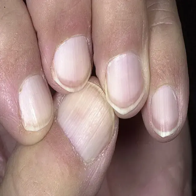 Matowe białe paznokcie u rąk