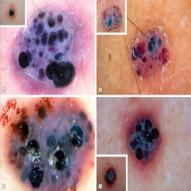 Rogowiec krwawy obrazy