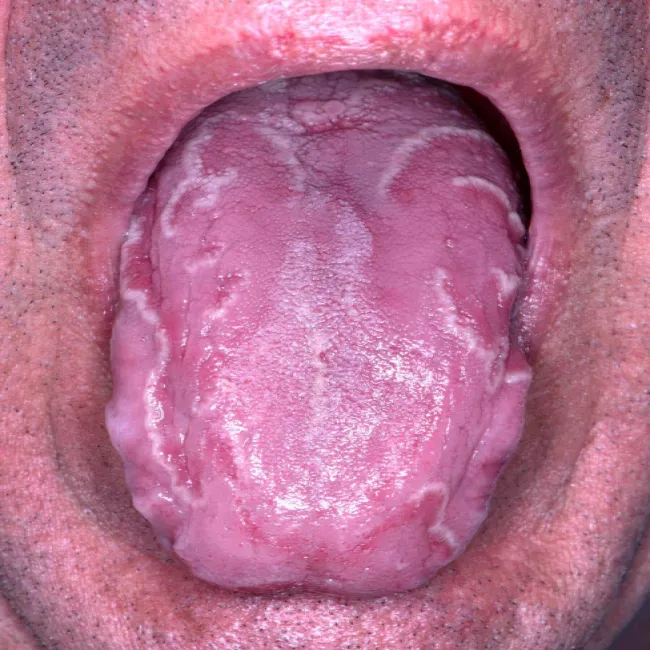 Stan na języku zwany język geograficzny