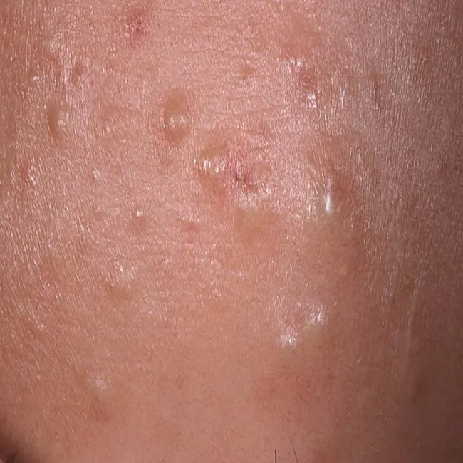 Wygląd zaskórniki zamknięte