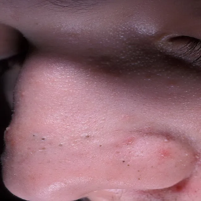 Zaskórniki otwarte brązowe lub czarne kropki