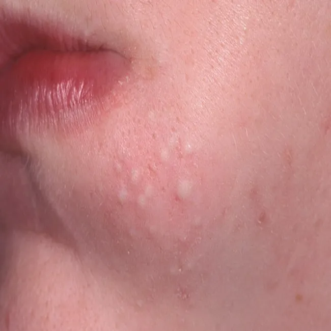 Zaskórniki zamknięte zdjęcie