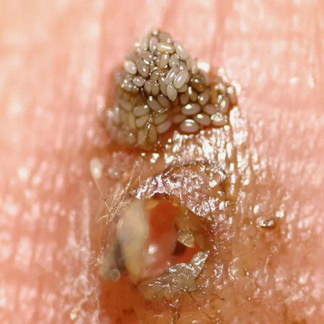 inwazja pchły piaskowej 