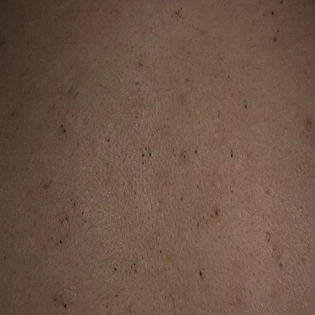 zaskórniki otwarte zdjęcie