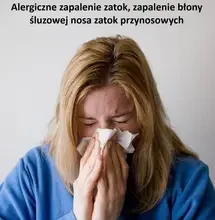 Alergiczne zapalenie zatok
