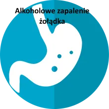 Alkoholowe zapalenie żołądka 