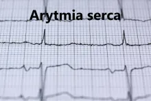 Arytmia serca