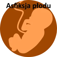 Asfiksja płodu