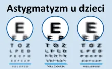 Astygmatyzm u dzieci 