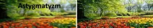 Astygmatyzm 