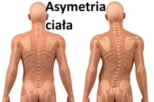 Asymetria ciała