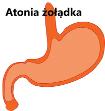 Atonia żołądka 