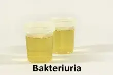 Bakteriuria