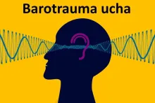 Barotrauma ucha 