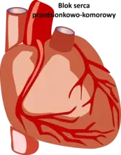 Blok serca przedsionkowo-komorowy
