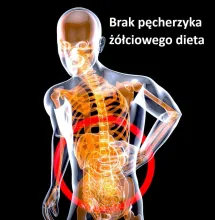 BRAK PĘCHERZYKA ŻÓŁCIOWEGO jak się żyje, co jeść jak się nie ma woreczka żółciowego