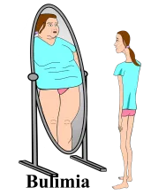 Bulimia 