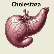 Cholestaza