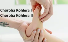 Choroba Köhlera I, Choroba Köhlera II 