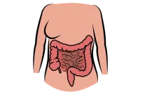 Choroba Leśniowskiego-Crohna