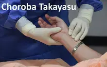 Choroba Takayasu, zespół Takayasu, zapalenie tętnic Takayasu, zapalna postać zespołu łuku aorty, choroba bez tętna