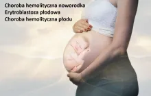 Choroba hemolityczna noworodka, erytroblastoza płodowa choroba hemolityczna płodu
