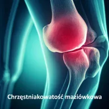  CHRZĘSTNIAKOWATOŚĆ MAZIÓWKOWA, synovial chondromatosis, SC 