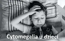 CYTOMEGALIA U DZIECI CMV objawy, ile trwa leczenie, rokowanie, gorączka inne objawy