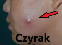 Czyrak 