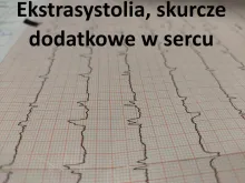 Ekstrasystolia, skurcze dodatkowe w sercu
