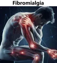 Fibromialgia , fibromyalgia syndrome FMS 