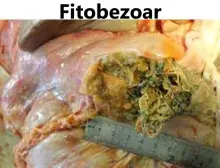 Fitobezoar 