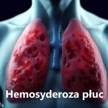 Hemosyderoza płuc, zespół Ceelena-Gellerstedta